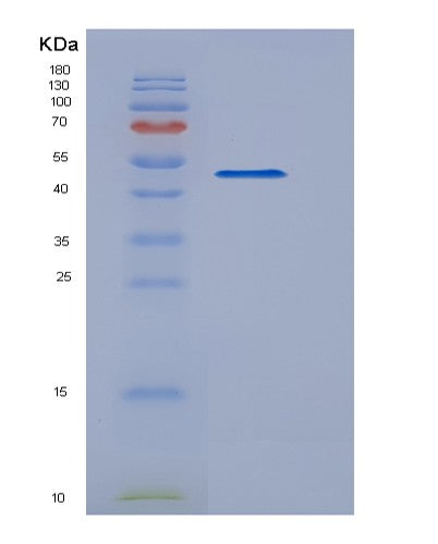 Human IFNL2 (Interferon Lambda-2) - Recombinant Protein