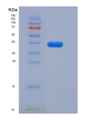 Human IGF1 (Insulin-Like Growth Factor 1) - Recombinant Protein