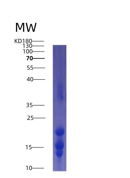 Human IL15 (Interleukin-15) - Recombinant Protein