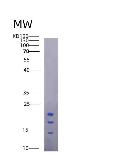 Mouse Il15 (Interleukin-15) - Recombinant Protein