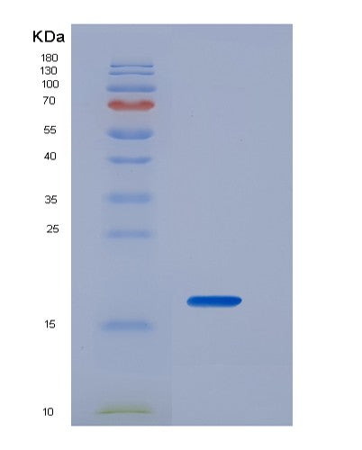 Human IL2 (Interleukin-2) - Recombinant Protein