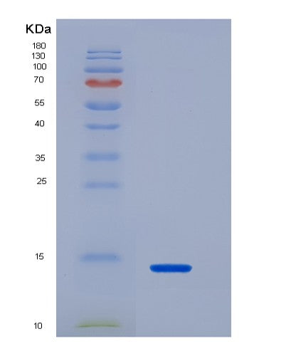 Human IL33 (Interleukin-33) - Recombinant Protein