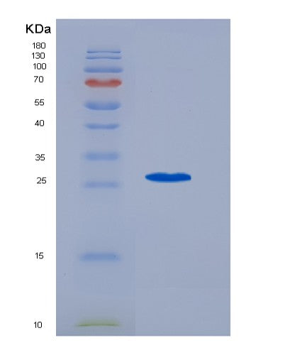 Human IL6 (Interleukin-6) - Recombinant Protein