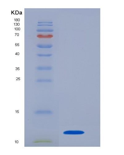 Human CXCL8 (Interleukin-8) - Recombinant Protein