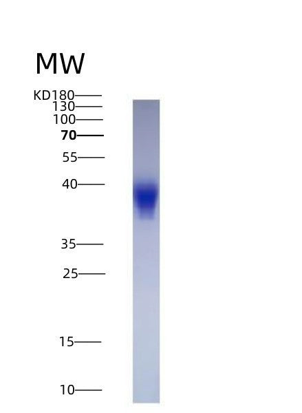 Human LIF (Leukemia Inhibitory Factor) - Recombinant Protein