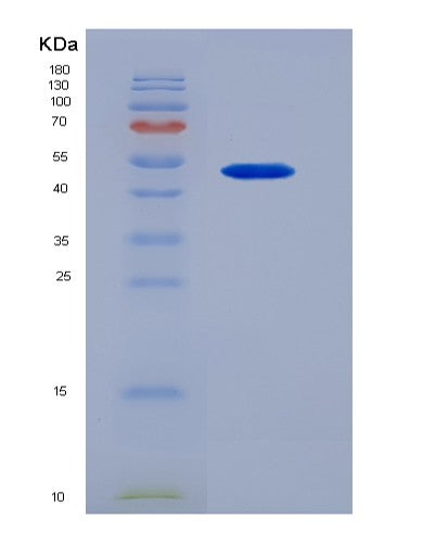 Human OSM (Oncostatin-M) - Recombinant Protein