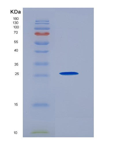 Human PDCD1LG2 (Programmed Cell Death 1 Ligand 2) - Recombinant Protein