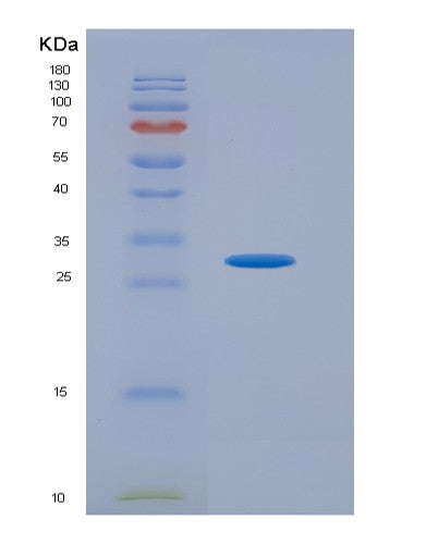 Human PDGFRA (Platelet-Derived Growth Factor Receptor Alpha) - Recombinant Protein