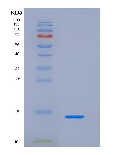 Human TFF1 (Trefoil Factor 1) - Recombinant Protein