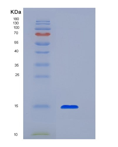Human TGFB1 (Transforming Growth Factor Beta-1 Proprotein) - Recombinant Protein
