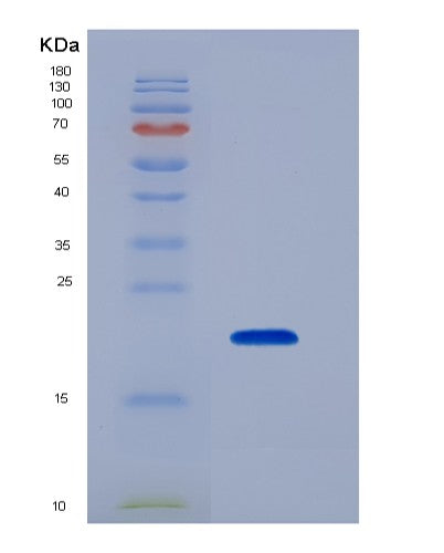 Human TNFRSF14 (Tumor Necrosis Factor Receptor Superfamily Member 14) - Recombinant Protein