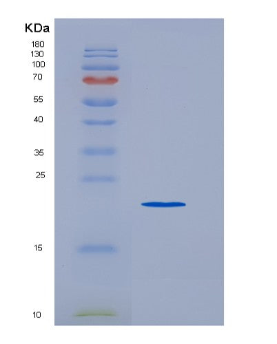 Human TNFRSF8 (Tumor Necrosis Factor Receptor Superfamily Member 8) - Recombinant Protein