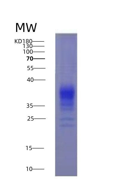 Human IFNG (Interferon Gamma) - Recombinant Protein