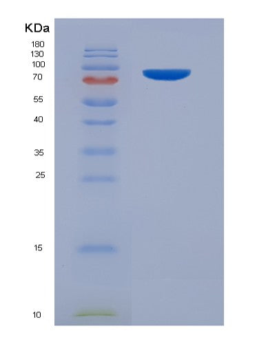 Human PECAM1 (Platelet Endothelial Cell Adhesion Molecule) - Recombinant Protein