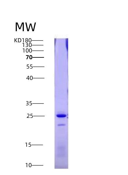 Human FAS (Tumor Necrosis Factor Receptor Superfamily Member 6) - Recombinant Protein