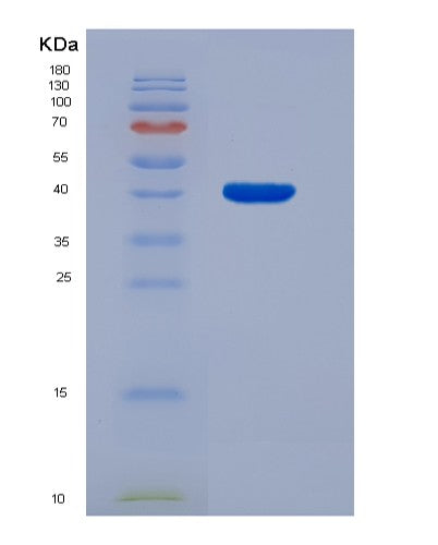 Human CD3E (T-Cell Surface Glycoprotein Cd3 Epsilon Chain) - Recombinant Protein