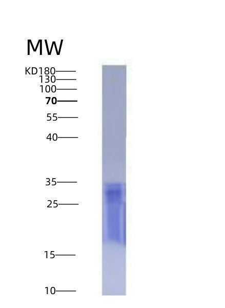 Human CD6 (T-Cell Differentiation Antigen Cd6) - Recombinant Protein