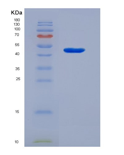 Human CD14 (Monocyte Differentiation Antigen Cd14) - Recombinant Protein