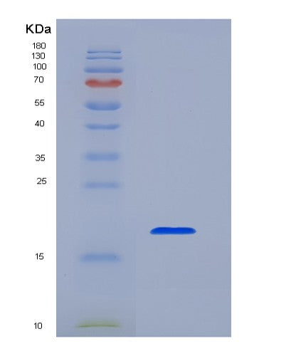 Human MS4A1 (B-Lymphocyte Antigen Cd20) - Recombinant Protein