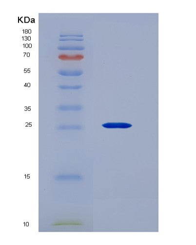 Human CD40LG (Cd40 Ligand) - Recombinant Protein
