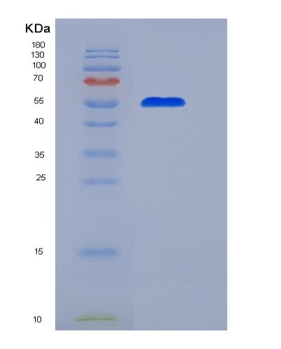 Human CD55 (Complement Decay-Accelerating Factor) - Recombinant Protein