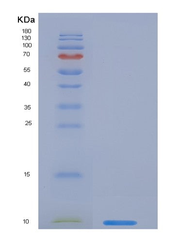 Human EGF (Pro-Epidermal Growth Factor) - Recombinant Protein