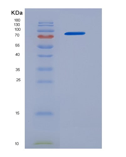 Human EGFR (Epidermal Growth Factor Receptor) - Recombinant Protein