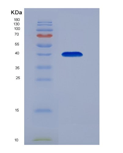 Human FCER2 (Low Affinity Immunoglobulin Epsilon Fc Receptor) - Recombinant Protein