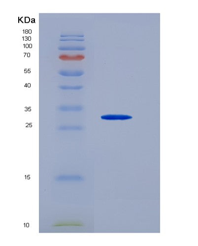 Human FGF8 (Fibroblast Growth Factor 8) - Recombinant Protein