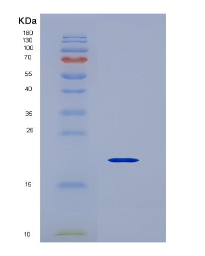Human VEGFD (Vascular Endothelial Growth Factor D) - Recombinant Protein