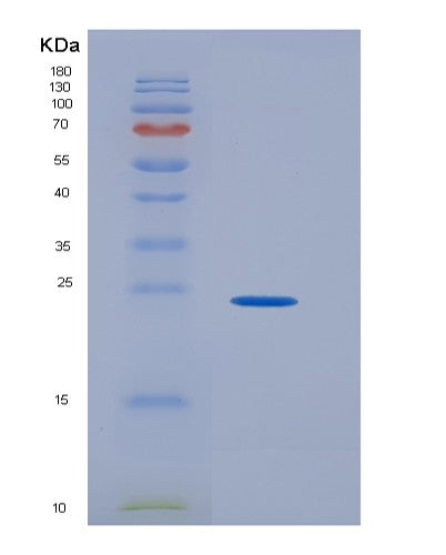 Human GH1 (Somatotropin) - Recombinant Protein