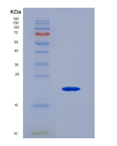 Human IL3 (Interleukin-3) - Recombinant Protein