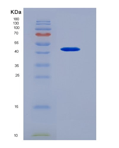 Human IL3 (Interleukin-3) - Recombinant Protein