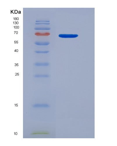 Human IL13 (Interleukin-13) - Recombinant Protein