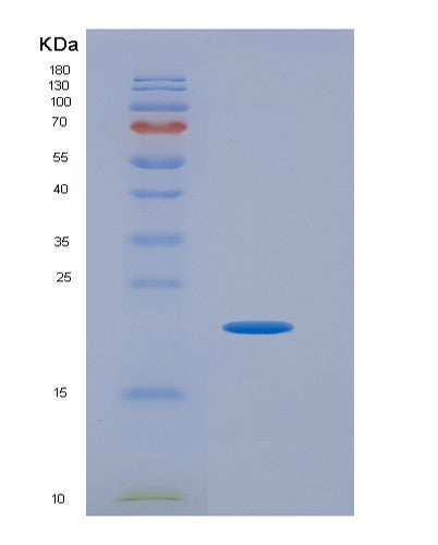 Human IL16 (Pro-Interleukin-16) - Recombinant Protein