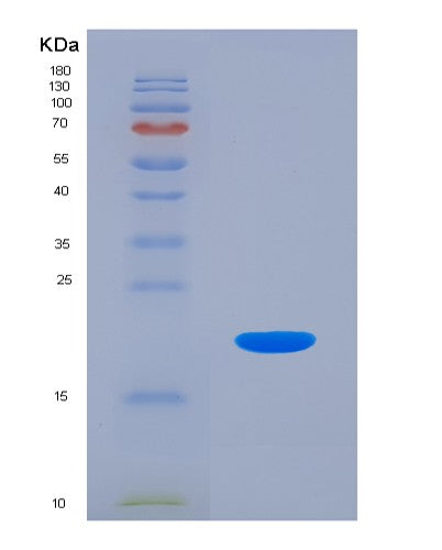 Human IL18 (Interleukin-18) - Recombinant Protein