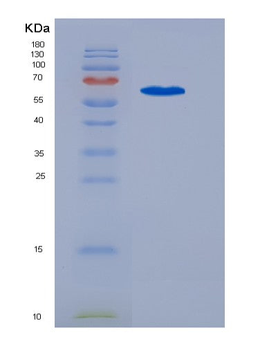 Human KIT (Mast/Stem Cell Growth Factor Receptor Kit) - Recombinant Protein