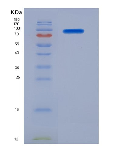 Human NCAM1 (Neural Cell Adhesion Molecule 1) - Recombinant Protein