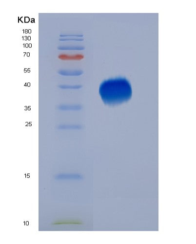 Human PDCD1 (Programmed Cell Death Protein 1) - Recombinant Protein