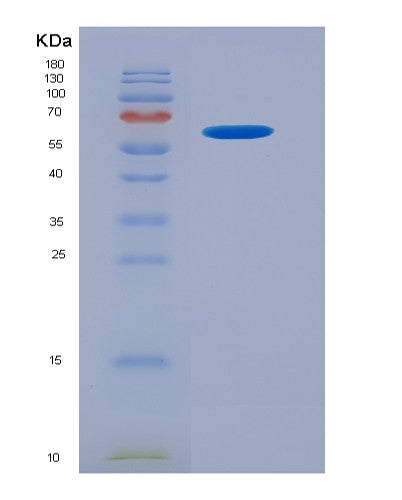 Human SDC1 (Syndecan-1) - Recombinant Protein