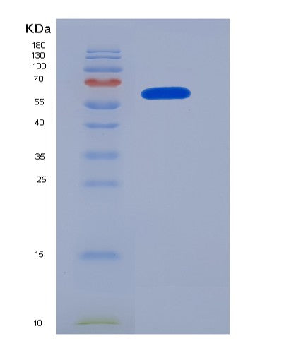 Human NRP1 (Neuropilin-1) - Recombinant Protein
