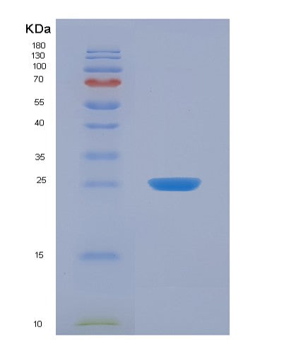 Human FIBP (Acidic Fibroblast Growth Factor Intracellular-Binding Protein) - Recombinant Protein