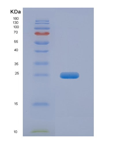 Human FGF19 (Fibroblast Growth Factor 19) - Recombinant Protein