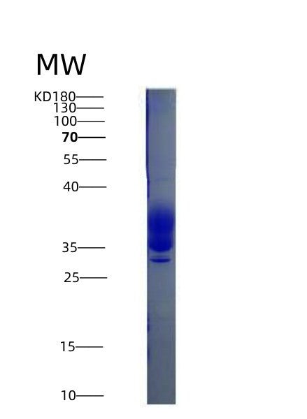 Mouse Csf1 (Macrophage Colony-Stimulating Factor 1) - Recombinant Protein