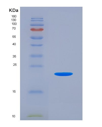 Mouse Csf2 (Granulocyte-Macrophage Colony-Stimulating Factor) - Recombinant Protein