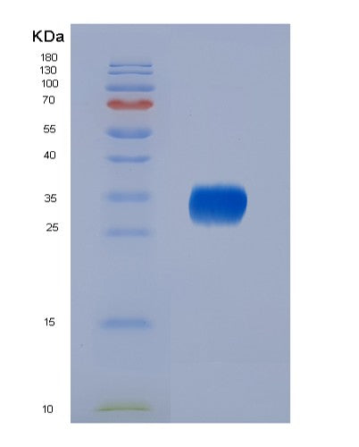 Mouse Il6 (Interleukin-6) - Recombinant Protein