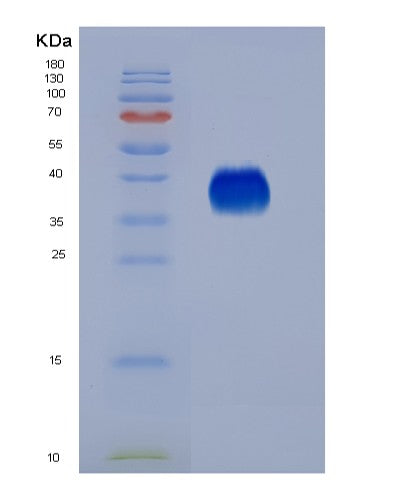 Mouse Il9 (Interleukin-9) - Recombinant Protein