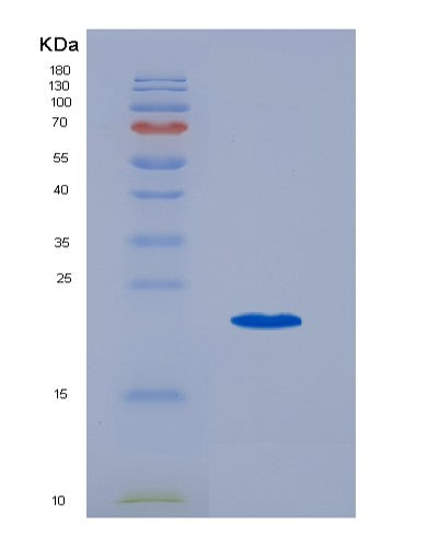 Mouse Lif (Leukemia Inhibitory Factor) - Recombinant Protein