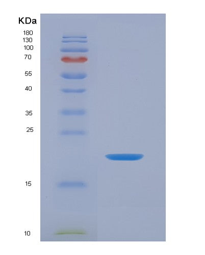 Human IL36G (Interleukin-36 Gamma) - Recombinant Protein
