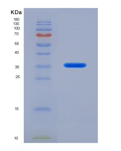 Human IL21 (Interleukin-21) - Recombinant Protein
